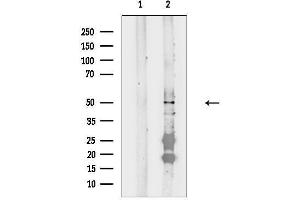 anti-Forkhead Box D4-Like 1 (FOXD4L1) antibody