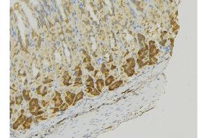 ABIN6273356 at 1/100 staining Human gastric tissue by IHC-P. (MCF2L 抗体  (Internal Region))