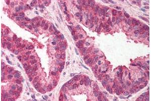 Human Prostate (formalin-fixed, paraffin-embedded) stained with TMED10 antibody ABIN214530 at 3 ng/ul followed by biotinylated goat anti-rabbit IgG secondary antibody ABIN481713, alkaline phosphatase-streptavidin and chromogen. (TMED10 抗体  (C-Term))