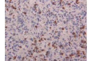 Detection of S100A4 in Human Spleen Tissue using Polyclonal Antibody to S100 Calcium Binding Protein A4 (S100A4) (s100a4 抗体  (AA 2-101))