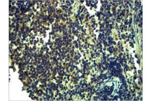 Immunohistochemical analysis of paraffin-embedded Mouse Spleen Tissue using TLR13 Polyclonal Antibody. (TLR13 抗体)