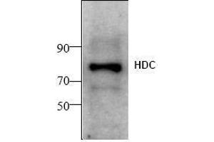 Image no. 1 for anti-Histidine Decarboxylase (HDC) antibody (ABIN155152) (HDC 抗体)