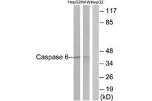 Western blot analysis of extracts from HepG2/RAW264.