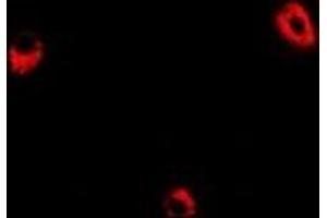 Immunofluorescent analysis of ADSS staining in Hela cells. (ADSS 抗体)