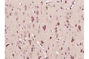 Paraformaldehyde-fixed, paraffin embedded Rat brain Antigen retrieval by boiling in sodium citrate buffer (pH6. (GABBR2 抗体  (AA 501-650))