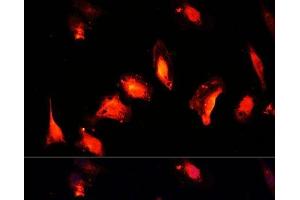 Immunofluorescence analysis of U-2 OS cells using MYST1 Polyclonal Antibody at dilution of 1:100 (40x lens). (MYST1 抗体)