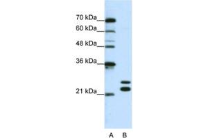 Western Blotting (WB) image for anti-Cold Shock Domain Containing C2, RNA Binding (CSDC2) antibody (ABIN2462255) (CSDC2 抗体)