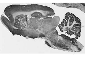 Adult rat brain immunohistochemistry. (CLCN3 抗体  (Cytosolic, N-Term))