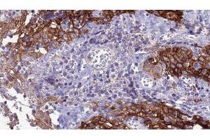 Immunohistochemistry (IHC) image for anti-Solute Carrier Family 39 (Zinc Transporter), Member 8 (SLC39A8) (Internal Region) antibody (ABIN6260260)