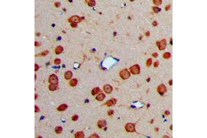 Immunohistochemical analysis of Fibulin 4 staining in human brain formalin fixed paraffin embedded tissue section. (FBLN4 抗体  (Center))