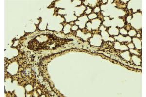 ABIN6273203 at 1/100 staining Mouse lung tissue by IHC-P. (C14orf166 抗体)