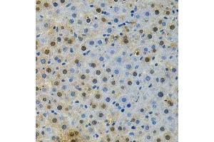 Immunohistochemistry of paraffin-embedded rat liver using BUB1 Antibody. (BUB1 抗体  (AA 1-300))