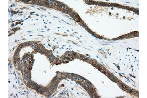 Image no. 6 for anti-Transforming, Acidic Coiled-Coil Containing Protein 3 (TACC3) antibody (ABIN1498098) (TACC3 抗体)