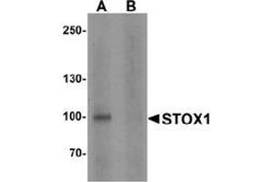 Western blot analysis of STOX1 in human liver tissue lysate with STOX1 antibody at 1 ug/ml in (A) the absence and (B) the presence of blocking peptide. (STOX1 抗体  (C-Term))