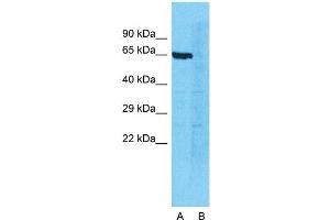 Western Blotting (WB) image for anti-DEAD (Asp-Glu-Ala-Asp) Box Polypeptide 41 (DDX41) (N-Term) antibody (ABIN2775230)