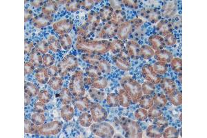 Used in DAB staining on fromalin fixed paraffin- embedded kidney tissue (BNP 抗体  (AA 27-121))