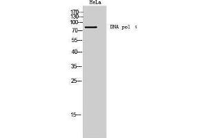 Western Blotting (WB) image for anti-DNA Polymerase I (C-Term) antibody (ABIN3180586) (DNA Polymerase I (C-Term) 抗体)