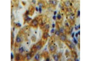 IHC-P analysis of Kidney tissue, with DAB staining. (Tissue factor 抗体  (AA 30-251))
