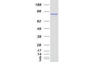Western Blotting (WB) image for Epidermal Growth Factor Receptor Pathway Substrate 8 (EPS8) protein (Myc-DYKDDDDK Tag) (ABIN2720340)
