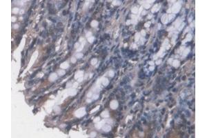 DAB staining on IHC-P; Samples: Mouse Colon Tissue (FPGT 抗体  (AA 314-513))