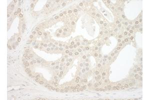 anti-Nucleolar Protein 12 (NOL12) (AA 75-125) antibody