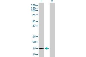 Western Blot analysis of BRWD1 expression in transfected 293T cell line by BRWD1 MaxPab polyclonal antibody. (BRWD1 抗体  (AA 1-120))