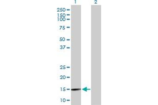 BRWD1 antibody  (AA 1-120)