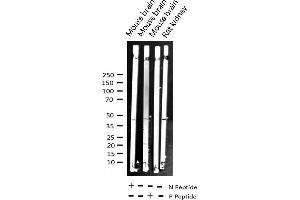 Western blot analysis of Phospho-I kappaB beta (Ser23) expression in various lysates