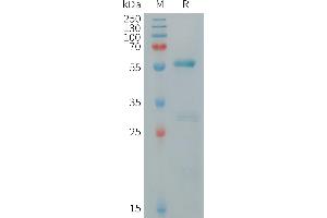 Human CA Protein, hFc Tag on SDS-PAGE under reducing condition.