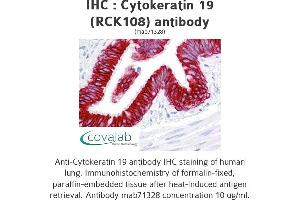 Image no. 1 for anti-Keratin 19 (KRT19) antibody (ABIN1724421) (Cytokeratin 19 抗体)