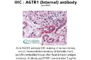 Image no. 2 for anti-Angiotensin II Receptor, Type 1 (AGTR1) (Internal Region) antibody (ABIN1731610)