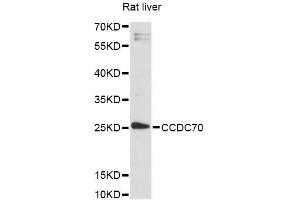 Western blot analysis of extracts of rat liver, using CCDC70 antibody (ABIN6292810) at 1:3000 dilution. (CCDC70 抗体)