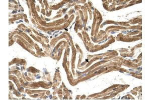 FICD antibody was used for immunohistochemistry at a concentration of 4-8 ug/ml to stain Skeletal muscle cells (arrows) in Human Muscle. (FICD 抗体  (C-Term))