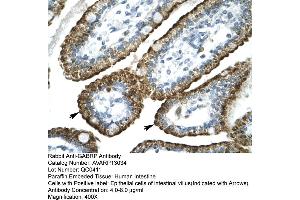 Human Intestine (GABRP 抗体  (N-Term))