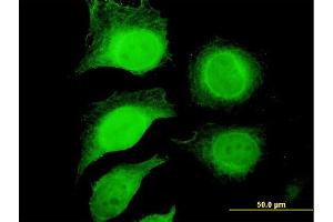Immunofluorescence of purified MaxPab antibody to GAPDH on HeLa cell. (GAPDH 抗体  (AA 1-335))