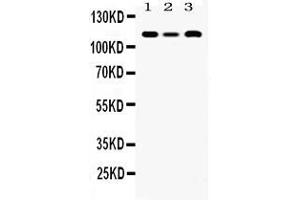 Western blot analysis of HLTF expression in rat cardiac muscle extract ( Lane 1), mouse spleen extract ( Lane 2) and human placenta extract ( Lane 3).