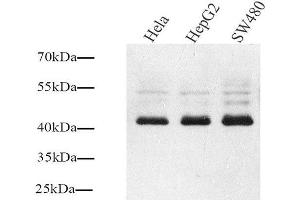 Western Blot analysis of various samples using Connexin 43 Polyclonal Antibody at dilution of 1:1000. (Connexin 43/GJA1 抗体)