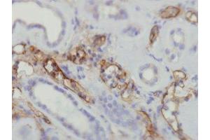 Immunohistochemistry (IHC) image for anti-Complement Component C4d (C4d) antibody (ABIN870587) (Complement C4d 抗体)