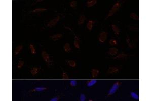 Immunofluorescence analysis of U-2 OS cells using ACAT1 Polyclonal Antibody at dilution of 1:100. (ACAT1 抗体)