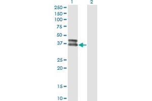 Western Blot analysis of OLIG2 expression in transfected 293T cell line by OLIG2 monoclonal antibody (M02), clone 3D7.