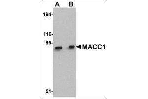 Western blot analysis of MACC1 in mouse liver tissue lysate with this product at (A) 1 and (B) 2 μg/ml. (MACC1 抗体  (Center))