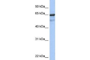 WB Suggested Anti-PCK1 Antibody Titration:  0. (PCK1 抗体  (N-Term))