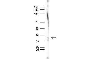 anti-Aminocarboxymuconate Semialdehyde Decarboxylase (ACMSD) antibody