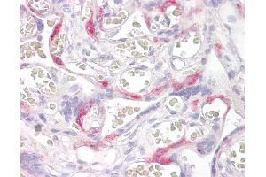 Anti-PHLDA2 antibody IHC of human placenta. (PHLDA2 抗体  (AA 139-152))