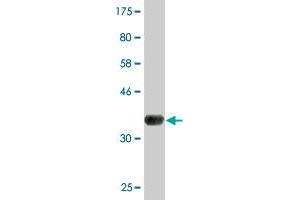 Western Blot detection against Immunogen (36. (AGTPBP1 抗体  (AA 1087-1186))