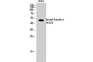 Western Blotting (WB) image for anti-alpha Tubulin (TUBA1) (acLys352) antibody (ABIN6285483) (alpha Tubulin 抗体  (acLys352))