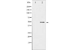Western blot analysis of ATF2 expression in HeLa whole cell lysates,The lane on the left is treated with the antigen-specific peptide. (ATF2 抗体  (N-Term))