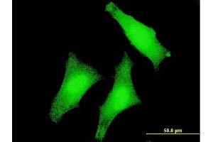 Immunofluorescence of monoclonal antibody to USP3 on HeLa cell. (USP3 抗体  (AA 421-520))