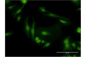 Immunofluorescence of monoclonal antibody to PDE6D on HeLa cell. (PDE6D 抗体  (AA 1-150))