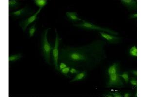 Immunofluorescence of monoclonal antibody to PDE6D on HeLa cell.